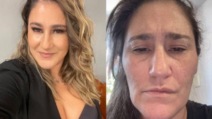   Belén Mora revela complejo problema de salud: 