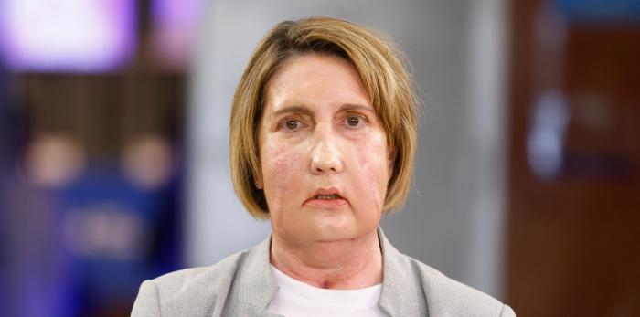 Imagen foto_00000016