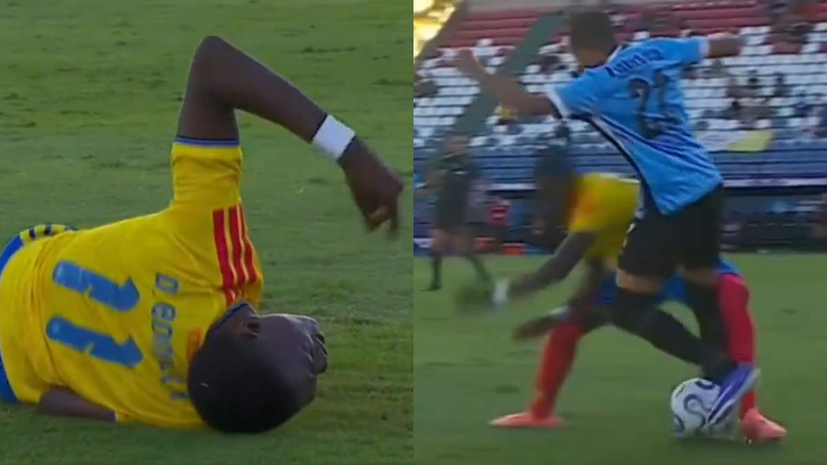 [VIDEO] Jugador de Colombia sufrió dolorosa lesión ante Uruguay en el Sudamericano Sub 17