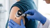 Muertes por cáncer a la piel aumentaron un 60% en la última década en Chile