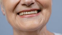 Colegio de Dentistas busca que las personas conserven 20 dientes al llegar a los 80 años