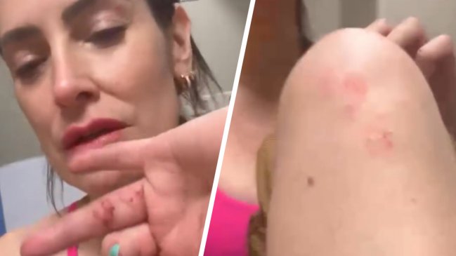 Adriana Barrientos sufrió violento portonazo en Las Condes