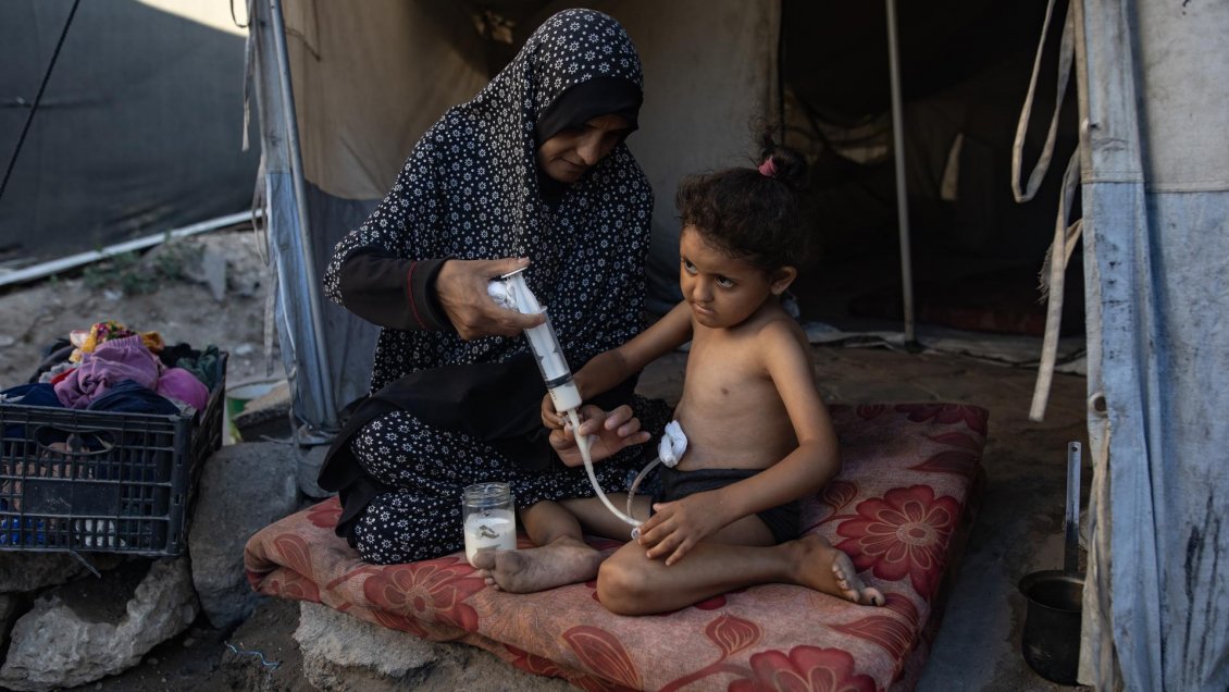 Alerta por brote de varicela en Gaza: Registró 9.300 casos en solo dos semanas