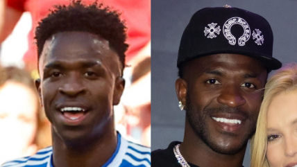 Irreconocible: Vinícius Júnior se realizó una cirugía estética de mentón tras el Mundial 2026