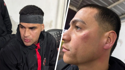   Jugadores de Patronato sufrieron grave agresión de sus hinchas tras derrota ante Colón 