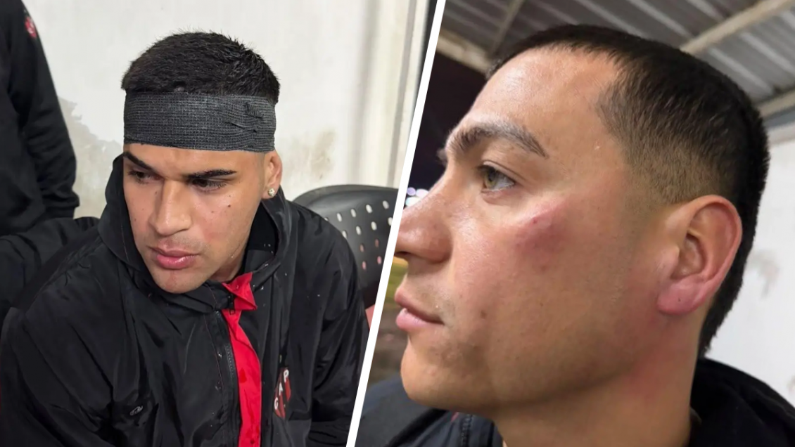 Jugadores de Patronato sufrieron grave agresión de sus hinchas tras derrota ante Colón