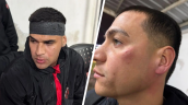 Jugadores de Patronato sufrieron grave agresión de sus hinchas tras derrota ante Colón