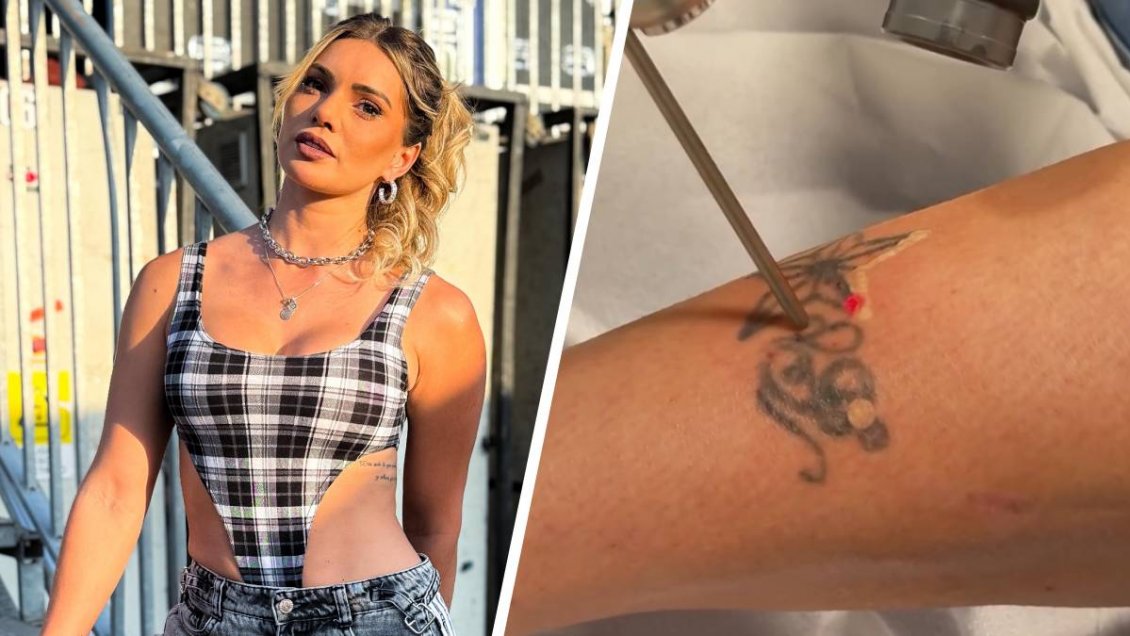 Faloon Larraguibel inició tratamiento para borrar sus tatuajes